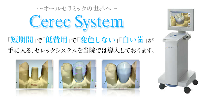 cerec system 「短期間」で「変色しにくい」「白い歯」が手に入る、セレックシステムを当院では導入しております。