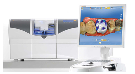 詰め物・被せ物